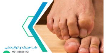 هالوکس ریجیدوس یا سفتی شست پا